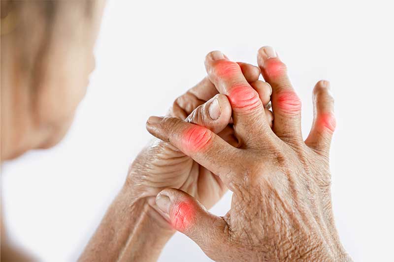 Types Of Arthritis & Tips To Manage Arthritis Symptoms