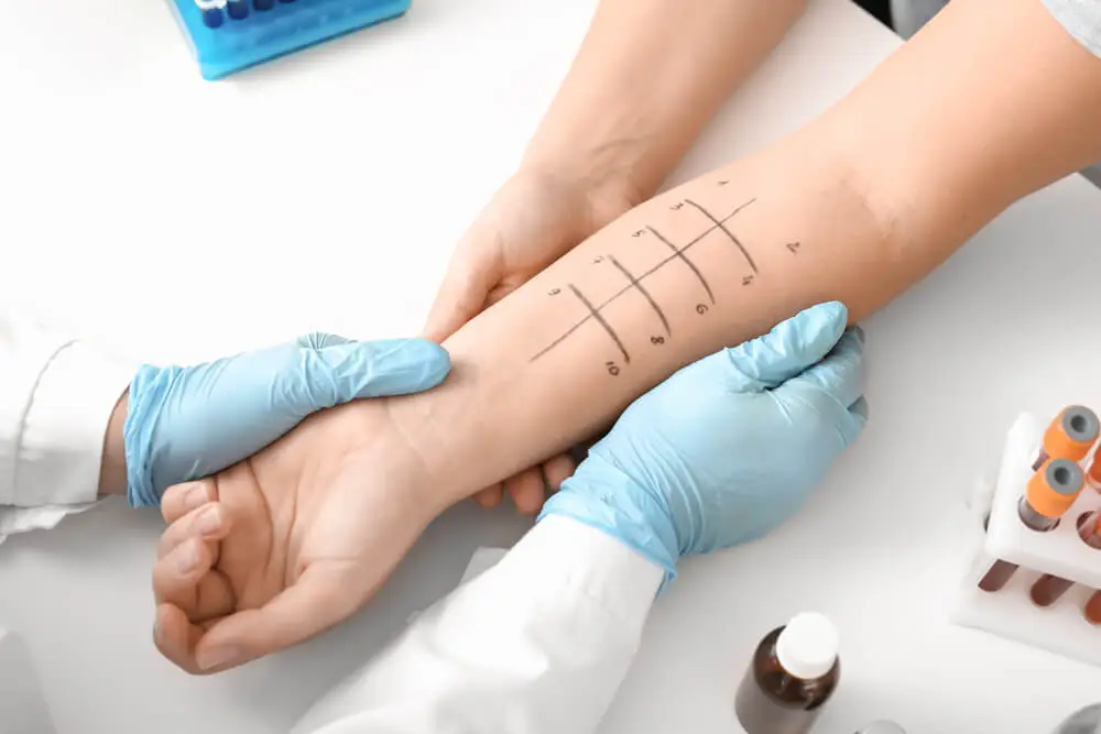 doctor testing allergic reaction on the arm of a patient in walk-in urgent care clinic