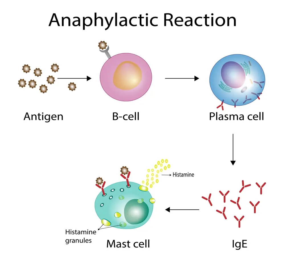 illustration showing an anaphylactic reaction (allergic reaction)