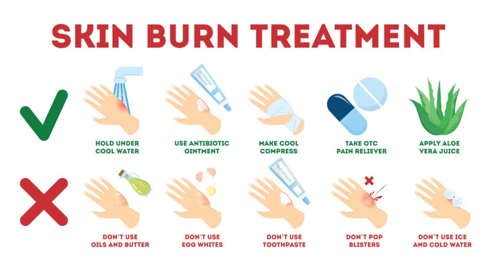 Skin burn treatment options