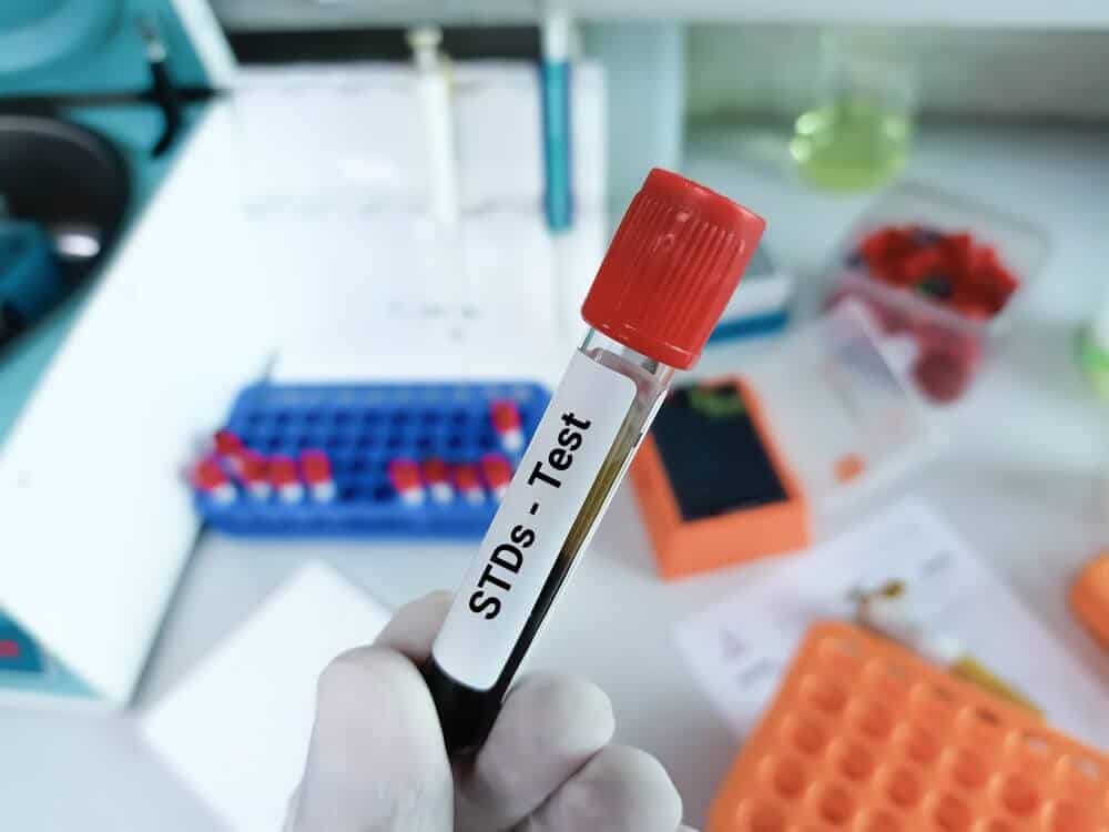 Biochemist holding a blood sample for a STD test - NextCare