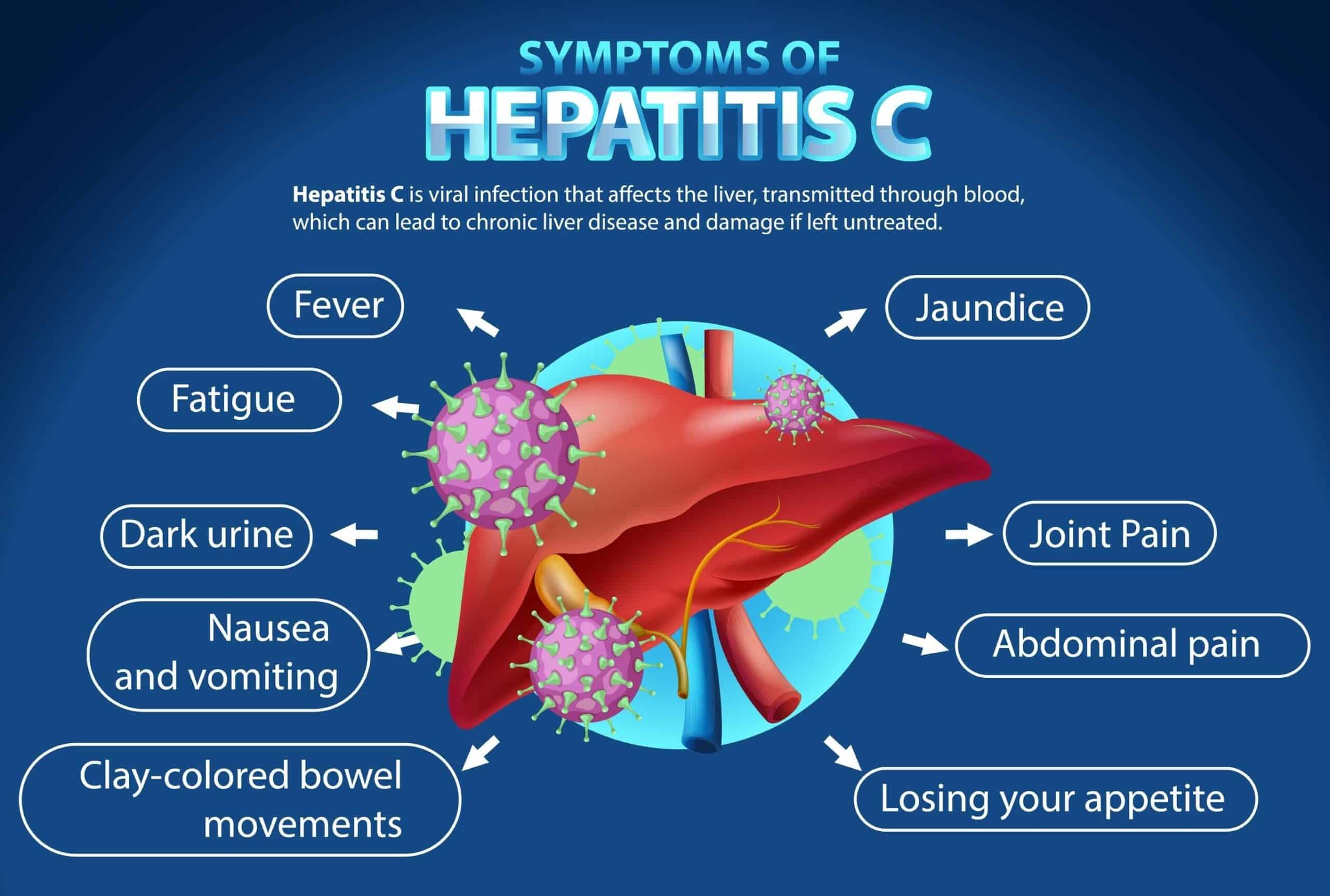image of a liver displaying symptoms of hepatitis-c