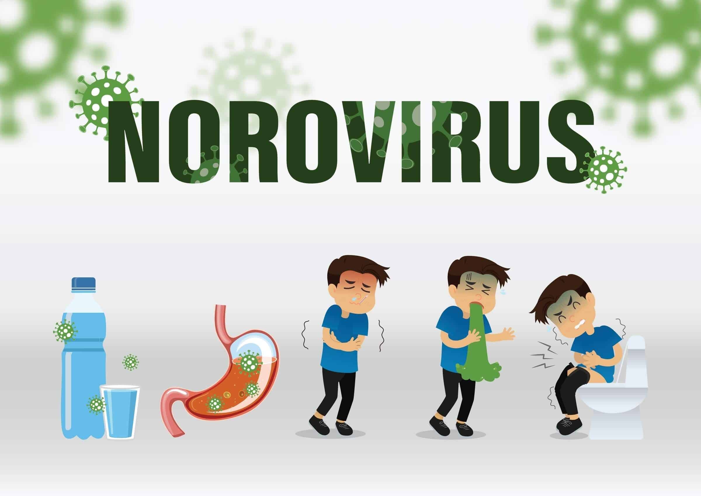 Illustration of norovirus symptoms and transmission, depicting stomach pain, nausea, vomiting, and diarrhea. Includes contamination from infected food and water - NextCare Urgent Care