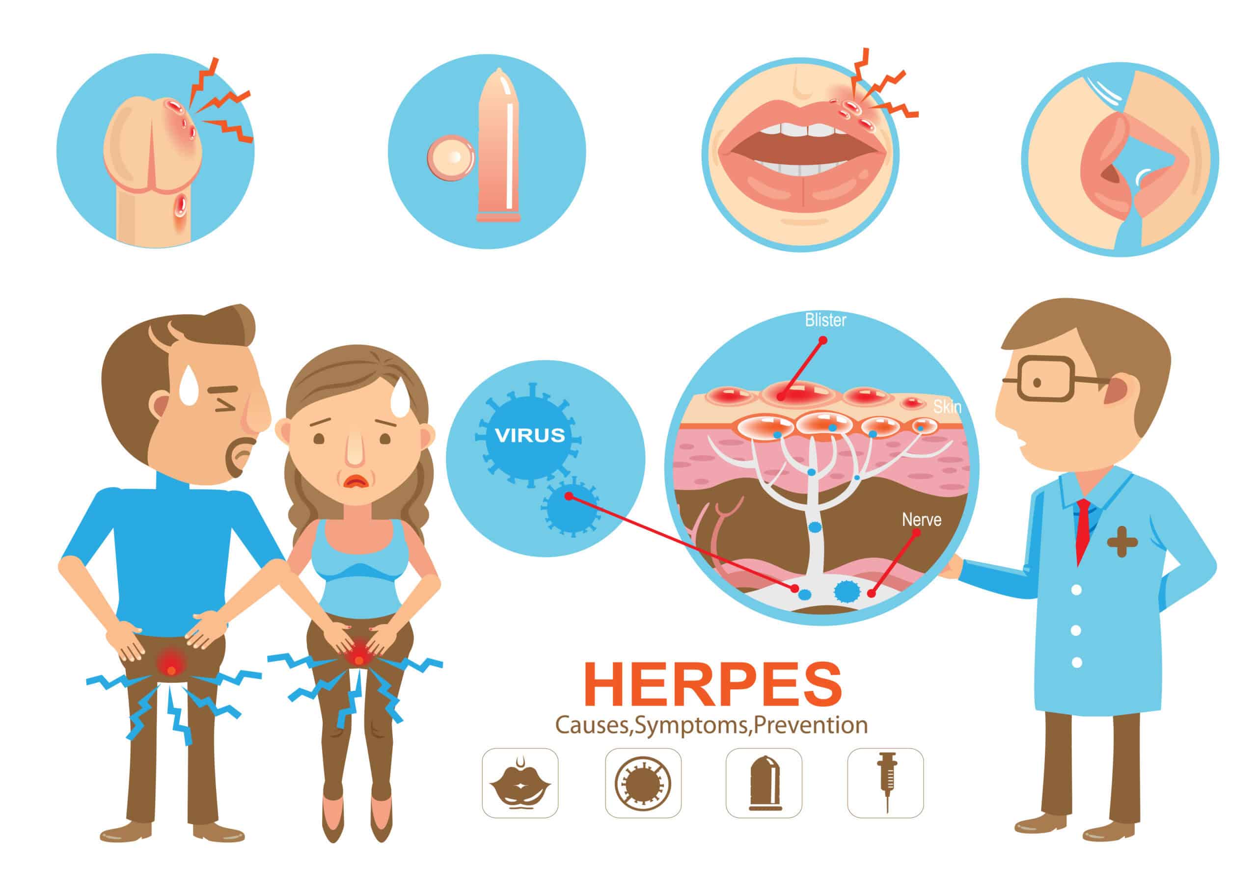 Genital Herpes Virus