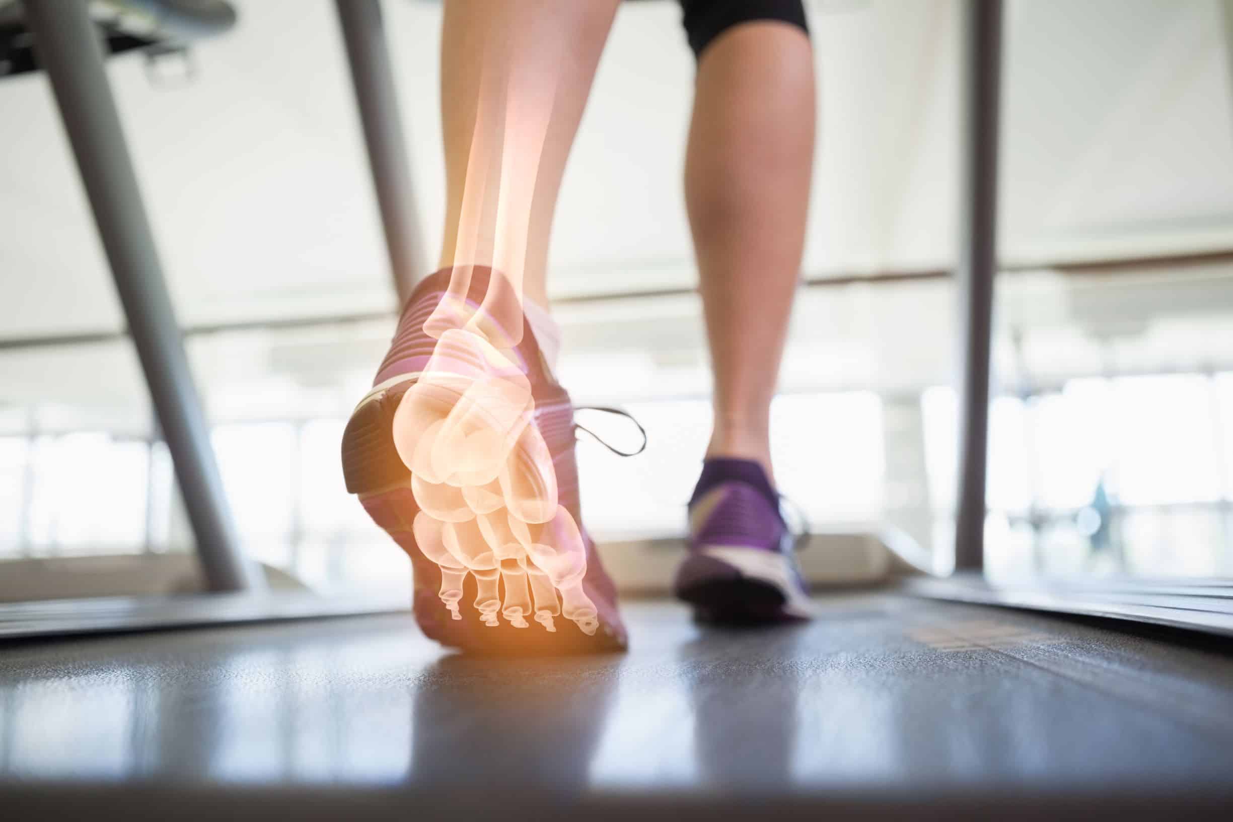 Foot Health: Problems & Solutions