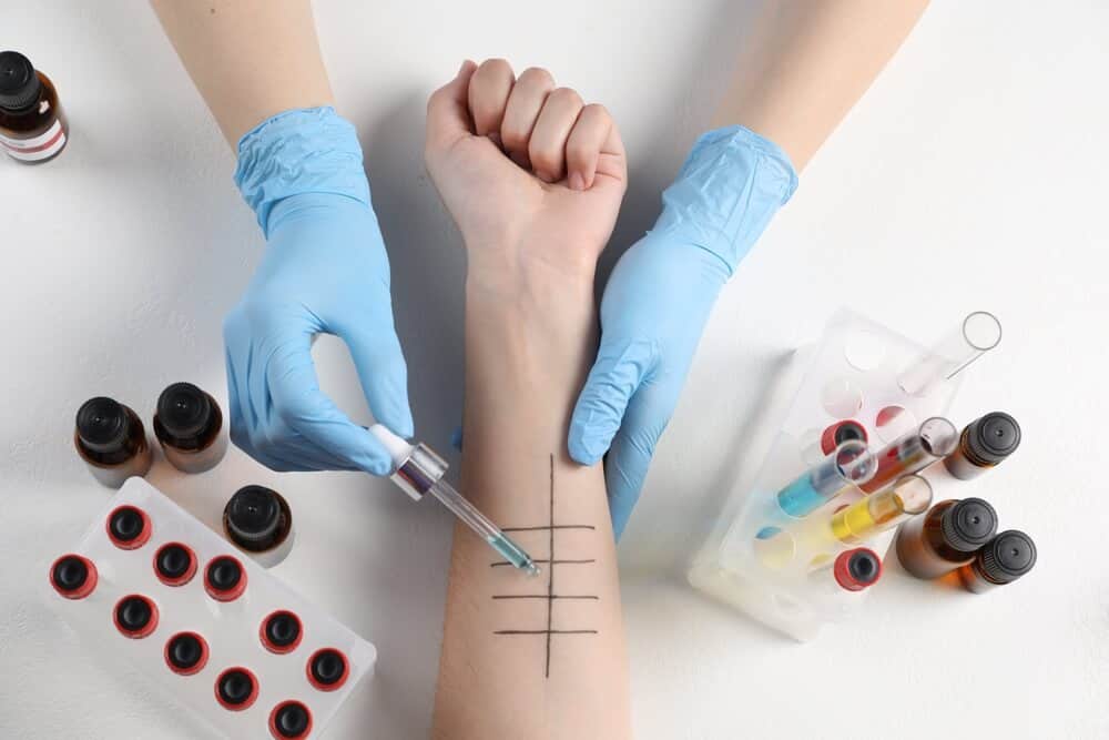 allergy testing urgent care health provider